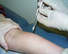 Botulinum toxin being injected into a calf muscle.